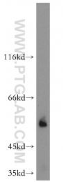 16922-1-AP - Vitamin D-binding protein