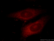 19003-1-AP - VEGF-A