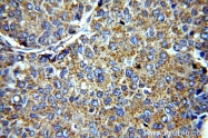 19003-1-AP - VEGF-A