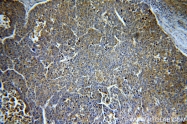 19003-1-AP - VEGF-A