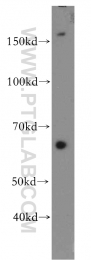 19493-1-AP - VLDL-R / VLDL receptor
