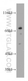 21745-1-AP - Vanin-1 / Pantetheinase