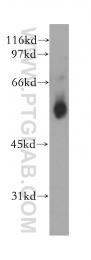 12946-1-AP - VRK2