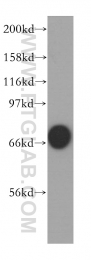 12946-1-AP - VRK2