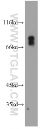 14145-1-AP - VSIG1