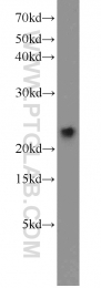 13919-1-AP - Visinin-like protein 1 / HLP3