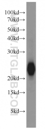 13919-1-AP - Visinin-like protein 1 / HLP3