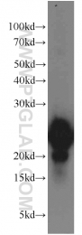 13919-1-AP - Visinin-like protein 1 / HLP3
