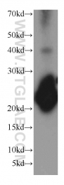 13919-1-AP - Visinin-like protein 1 / HLP3