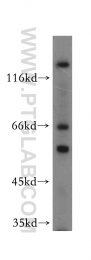 14306-1-AP - WASL / N-WASP
