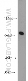 10316-1-AP - WBP11