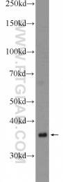 22587-1-AP - WBP2NL
