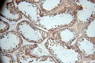 13676-1-AP - WDR1 / NORI-1