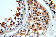 20483-1-AP - WDR32