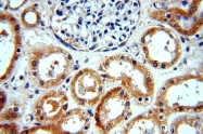 20483-1-AP - WDR32