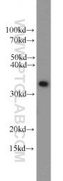 22536-1-AP - WDR61