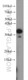 22536-1-AP - WDR61