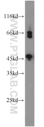 17983-1-AP - WNT3