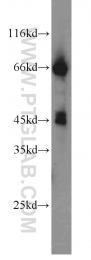 17983-1-AP - WNT3