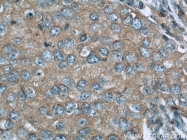 21414-1-AP - WNT3A