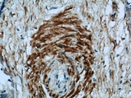 21414-1-AP - WNT3A
