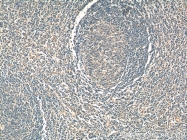55184-1-AP - WNT5A