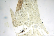 14761-1-AP - WDR79 / TCAB1