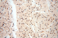 14761-1-AP - WDR79 / TCAB1