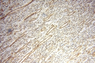 14761-1-AP - WDR79 / TCAB1