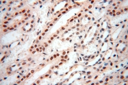 14761-1-AP - WDR79 / TCAB1