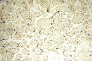 14761-1-AP - WDR79 / TCAB1