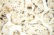14761-1-AP - WDR79 / TCAB1