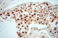 14761-1-AP - WDR79 / TCAB1