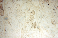14761-1-AP - WDR79 / TCAB1