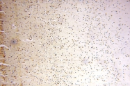 14761-1-AP - WDR79 / TCAB1