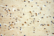 14761-1-AP - WDR79 / TCAB1