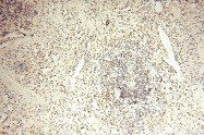 14761-1-AP - WDR79 / TCAB1