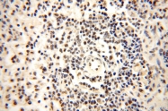 14761-1-AP - WDR79 / TCAB1