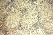 14761-1-AP - WDR79 / TCAB1
