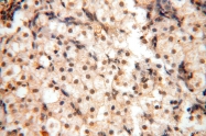 14761-1-AP - WDR79 / TCAB1