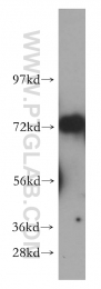 14761-1-AP - WDR79 / TCAB1