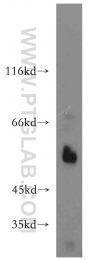 12609-1-AP - WT1 / Wilms tumor protein