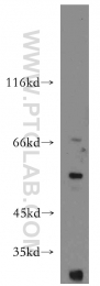 12609-1-AP - WT1 / Wilms tumor protein
