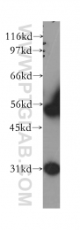 12609-1-AP - WT1 / Wilms tumor protein