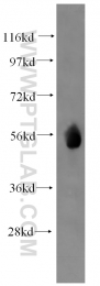 12609-1-AP - WT1 / Wilms tumor protein