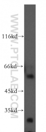 12609-1-AP - WT1 / Wilms tumor protein