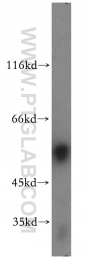 12609-1-AP - WT1 / Wilms tumor protein