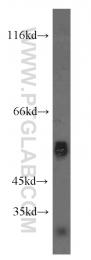 12609-1-AP - WT1 / Wilms tumor protein