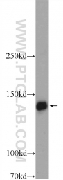 24750-1-AP - WWC2 / BOMB