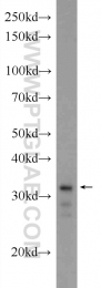 24168-1-AP - XBP1 / TREB5